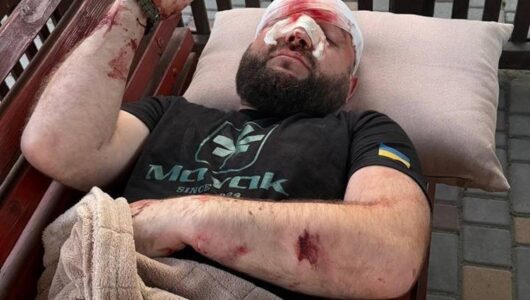 На Одещині жорстоко побили військовослужбовця за зауваження щодо російської музики